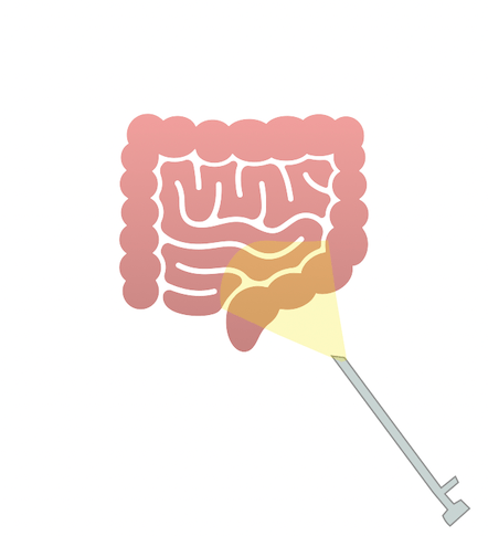 Minimally Invasive Colorectal Surgery