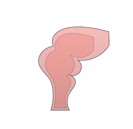 Rectal and Anal Surgeries
