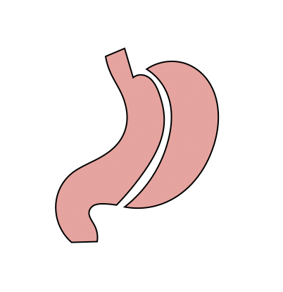 Bariatric and Metabolic Surgery