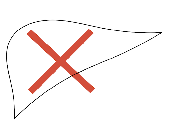 Contraindications (When transplant cannot be done)
